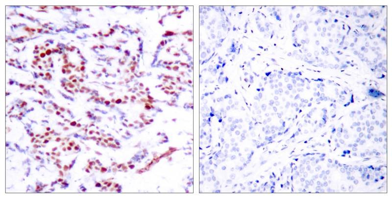 Anti-Phospho-ATF2 (Ser112 or 94) Polyclonal Antibody