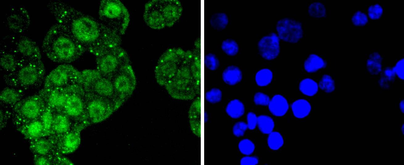 Anti-ATF2 Antibody (4L818)