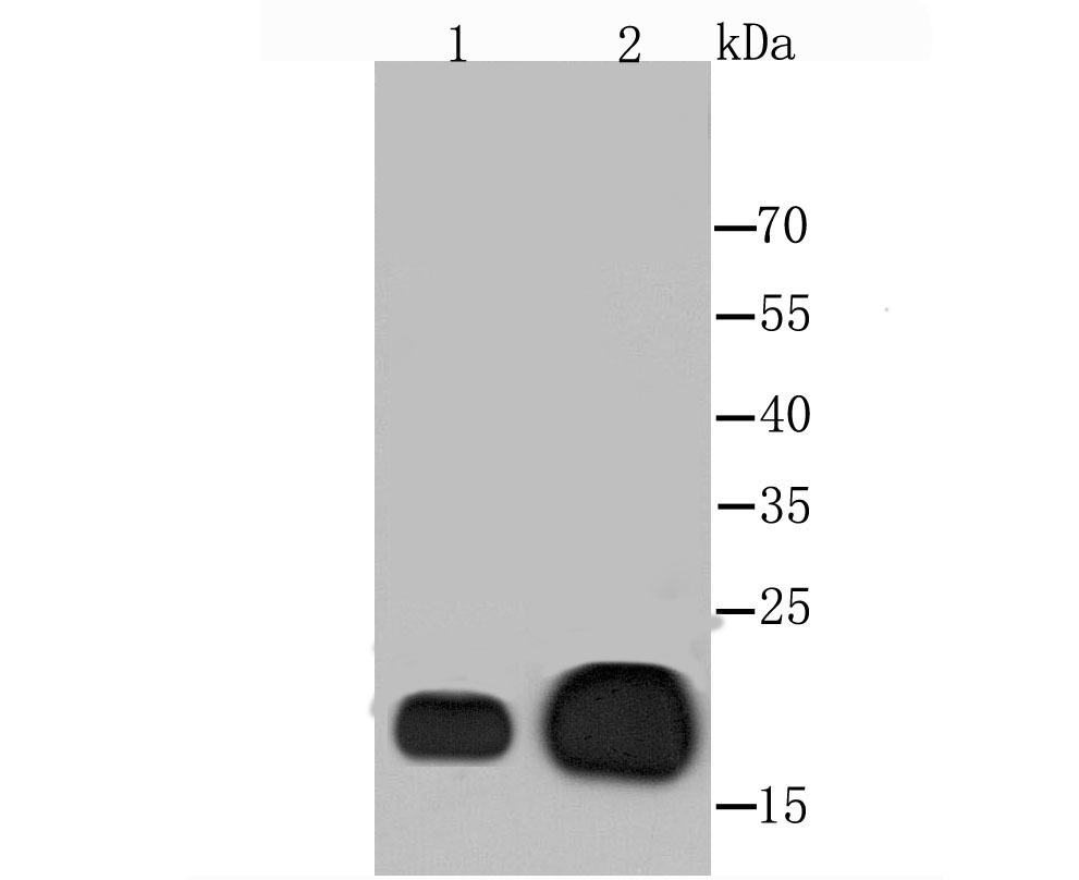 Anti-CRYAB Antibody (6W222)