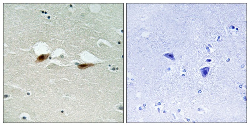 Anti-Phospho-ATF2 (Ser472) Polyclonal Antibody
