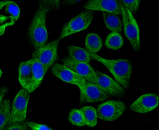Anti-Arp3/ACTR3 Antibody (1Q436)
