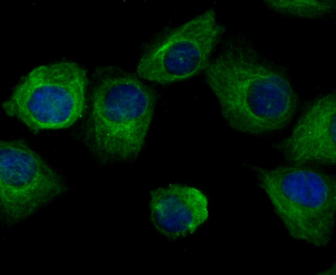 Anti-Arp3/ACTR3 Antibody (1Q436)
