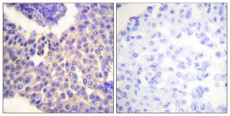 Anti-Phospho-ARRB1 (Ser412) Polyclonal Antibody