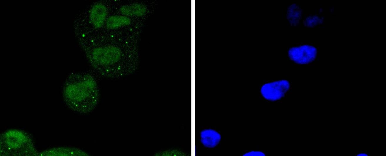 Anti-ATF2 Antibody (4L818)