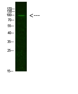 Anti-Acetyl-Androgen receptor (Lys631) Polyclonal Antibody