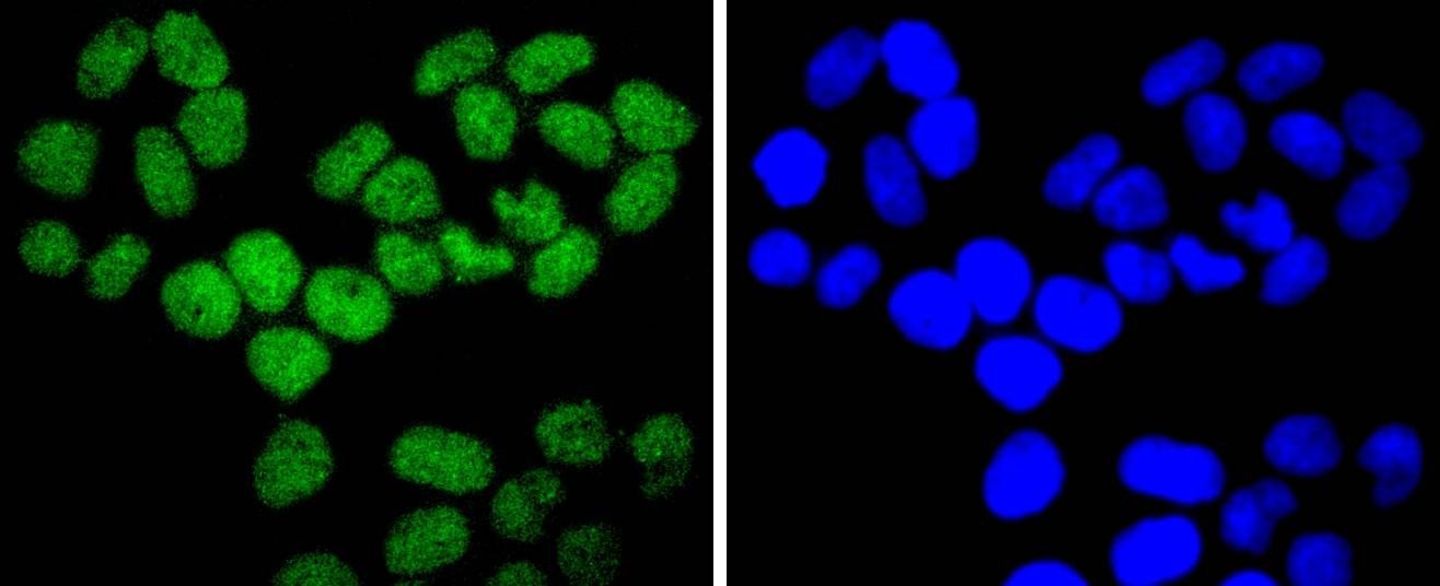 Anti-ARID1A Antibody (2S979)