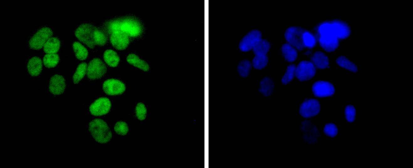 Anti-ARID1A Antibody (2S979)