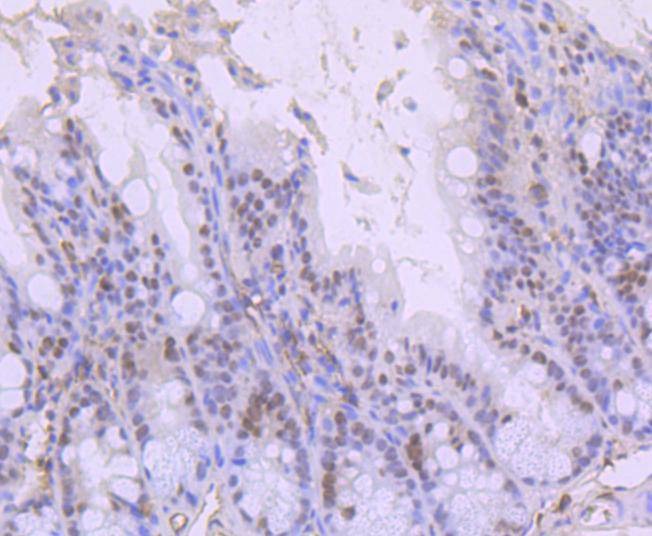 Anti-ARID1A Antibody (2S979)