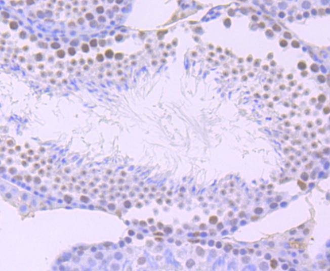 Anti-ARID1A Antibody (2S979)
