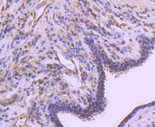 Anti-A-Raf Antibody (2P32)