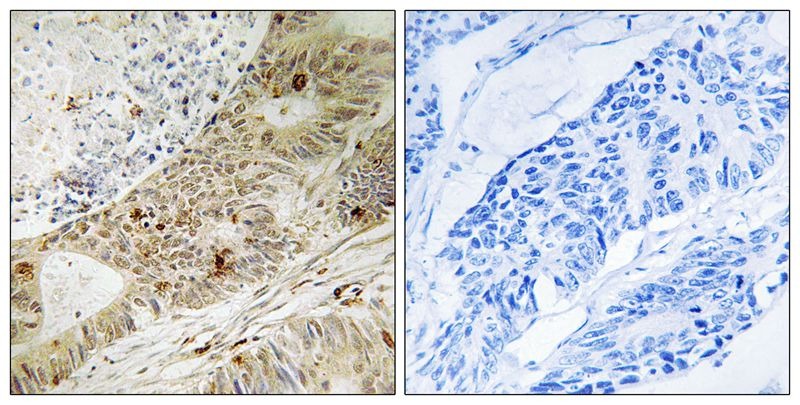 Anti-Phospho-ATRIP (Ser224) Polyclonal Antibody