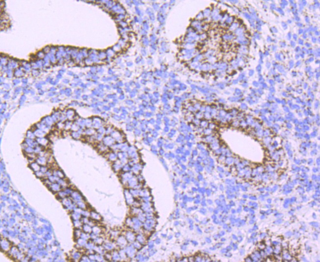 Anti-ATP5B Antibody (8V910)