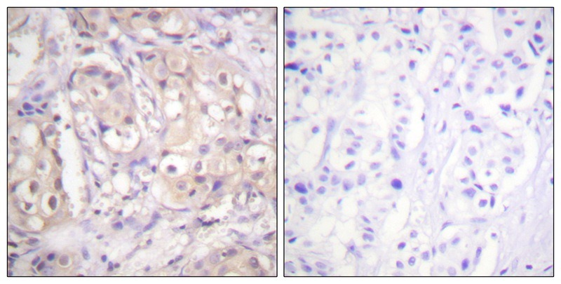 Anti-Phospho-BRAF (Thr599) Polyclonal Antibody 2