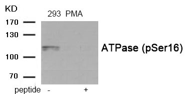 Anti-Phospho-ATP1A1 (Ser16) Polyclonal Antibody 2
