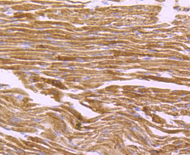 Anti-ATP5B Antibody (8V910)