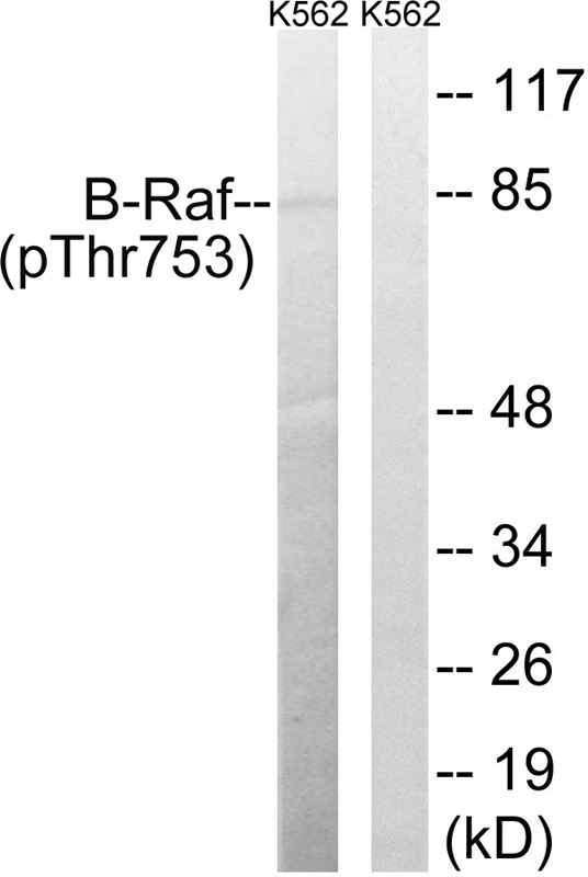 Anti-Phospho-BRAF (Thr753) Polyclonal Antibody 2