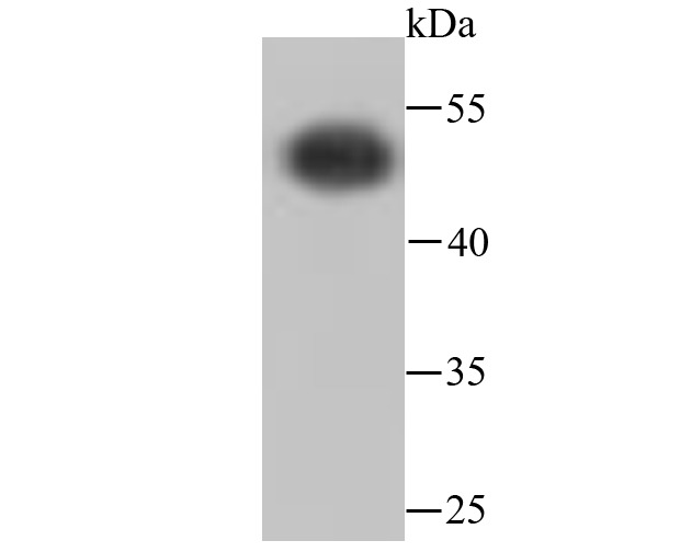 Anti-ATP5B Antibody (8V910)