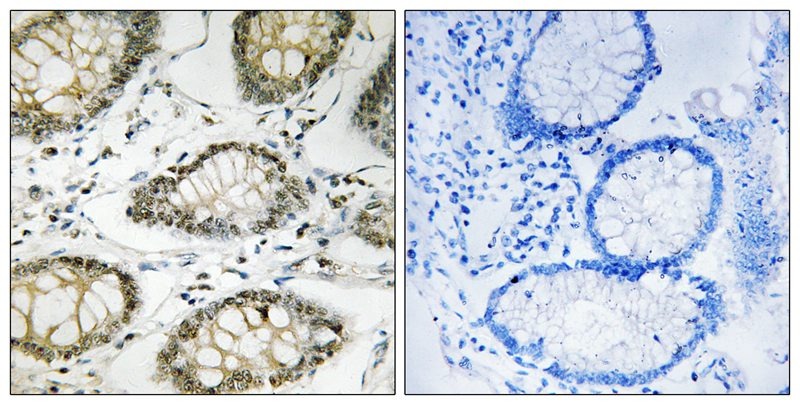 Anti-Phospho-ATR (Ser428) Polyclonal Antibody