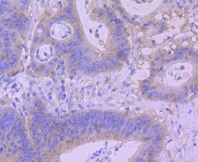 Anti-BNIP3 Antibody (3L227)
