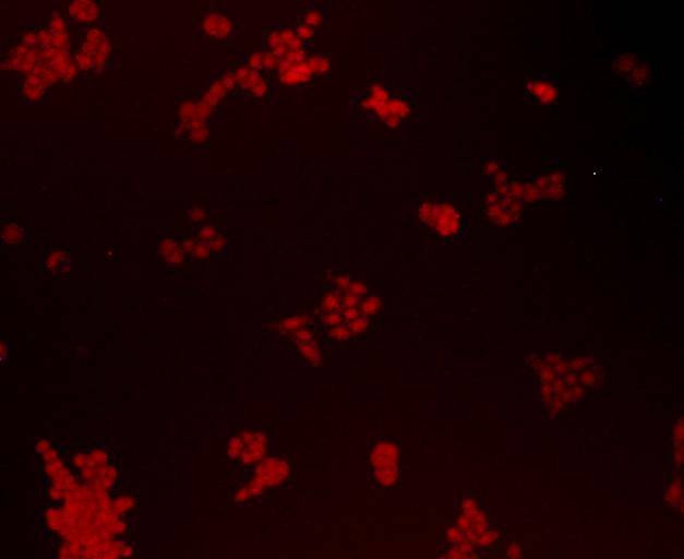 Anti-BMI-1 Antibody (8M743)
