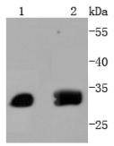 Anti-ATF-5 Antibody (6Y194)