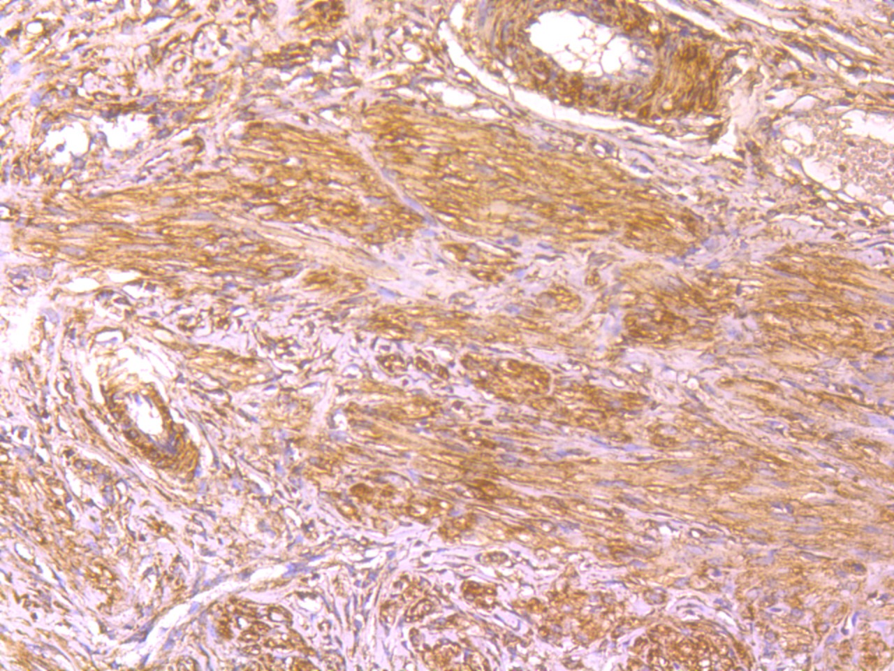 Anti-BLCAP Antibody (7F556)
