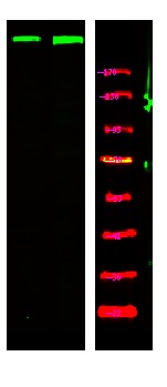 Anti-Phospho-ATM (Ser367) Polyclonal Antibody