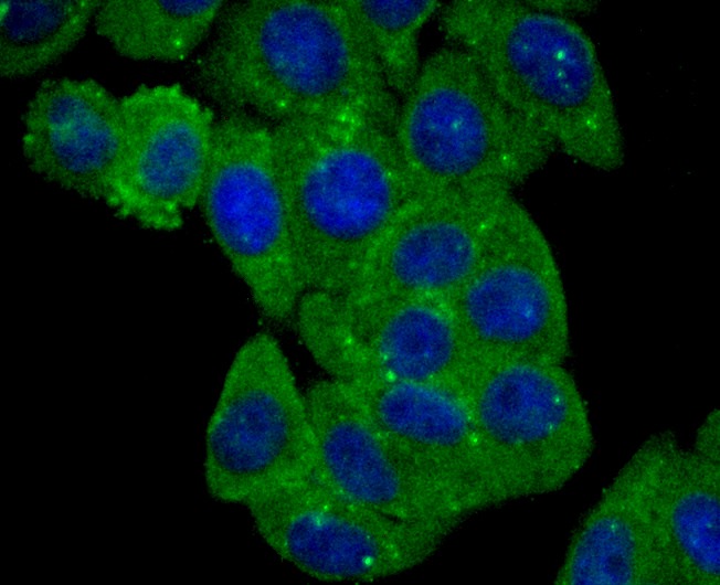 Anti-BLCAP Antibody (7F556)