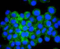 Anti-ATF-4 Antibody (7M603)