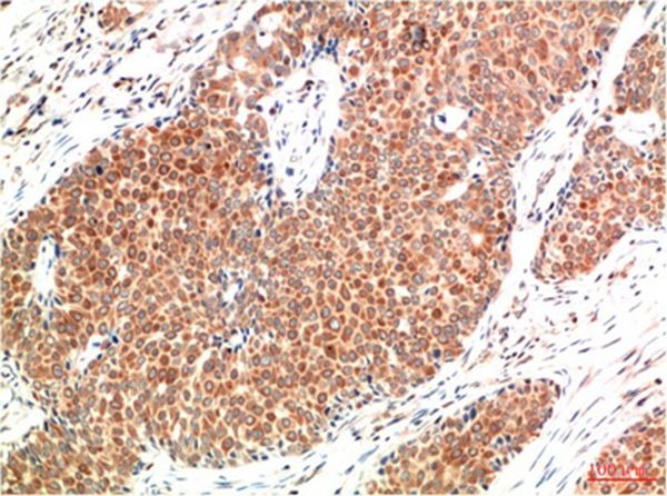 Anti-ATM Antibody (6V835)