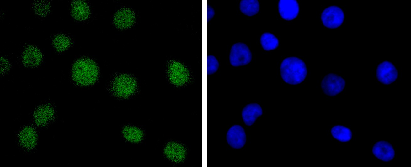 Anti-BMI-1 Antibody (4I124)