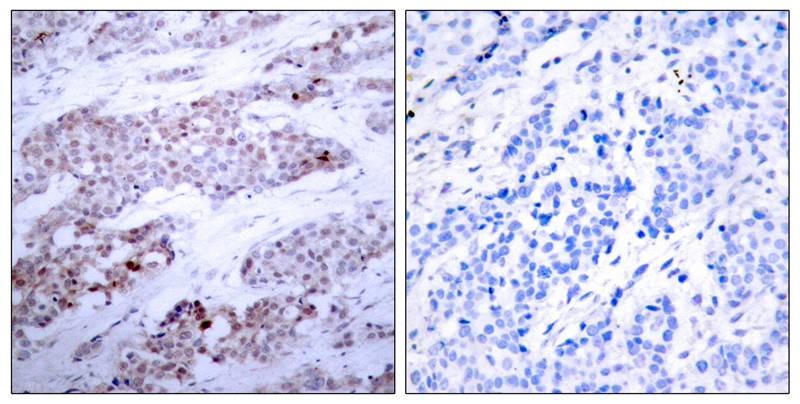 Anti-Phospho-ATF-4 (Ser245) Polyclonal Antibody 2