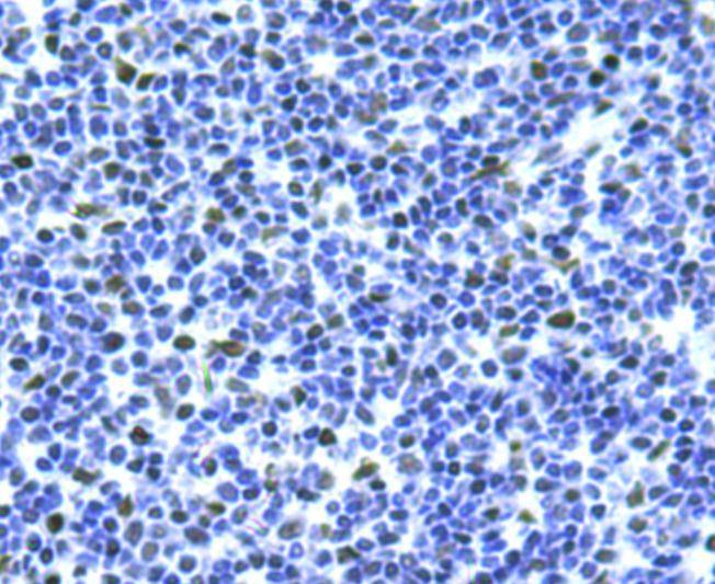 Anti-BMI-1 Antibody (8M743)