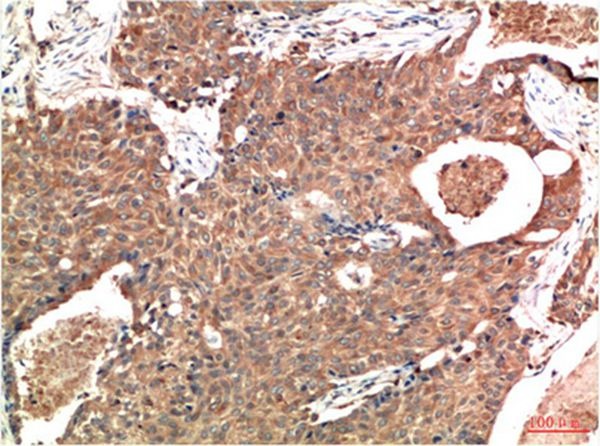 Anti-ATM Antibody (2R4)