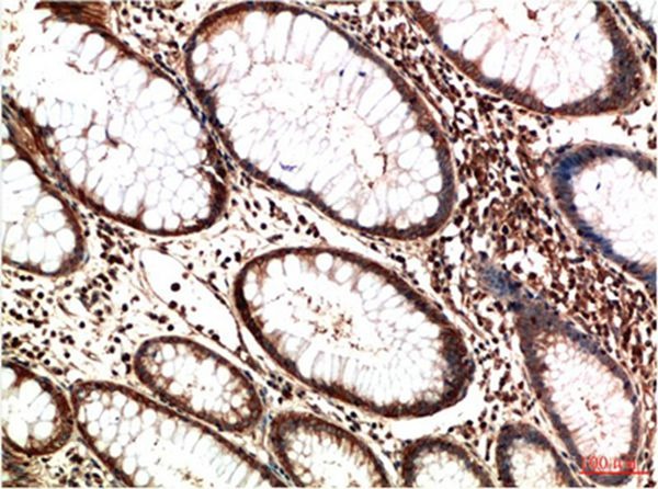 Anti-ATM Antibody (2R4)