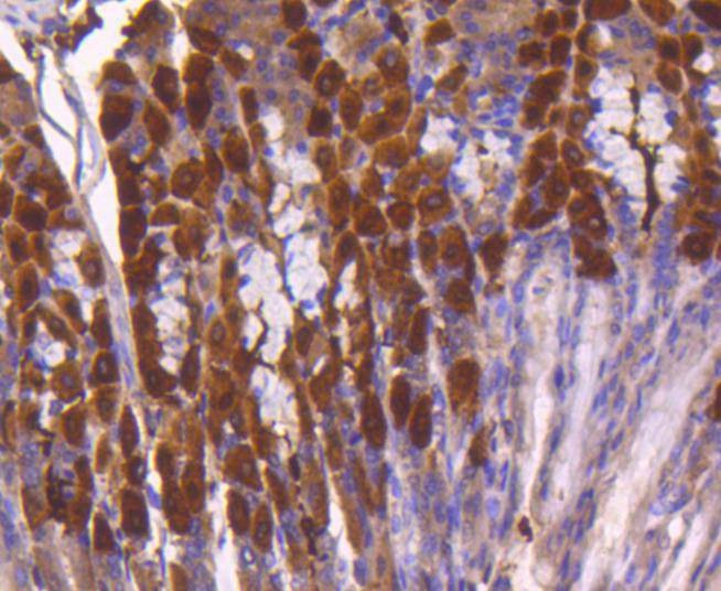 Anti-ATF-5 Antibody (6Y194)