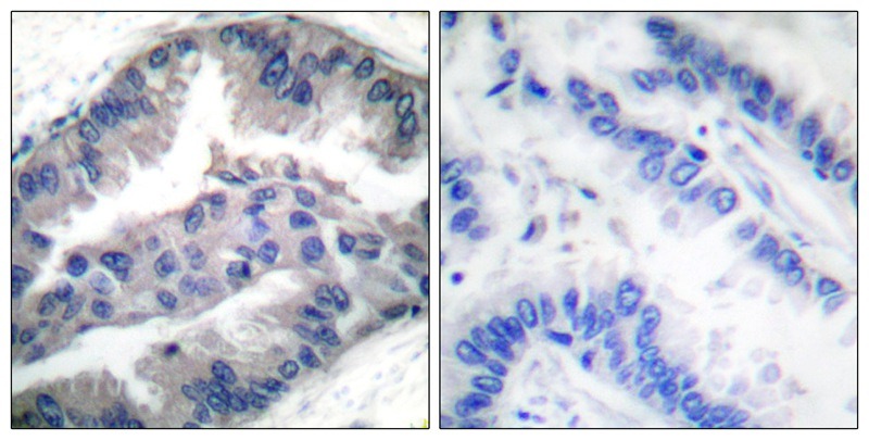 Anti-Phospho-BIK (Thr33) Polyclonal Antibody