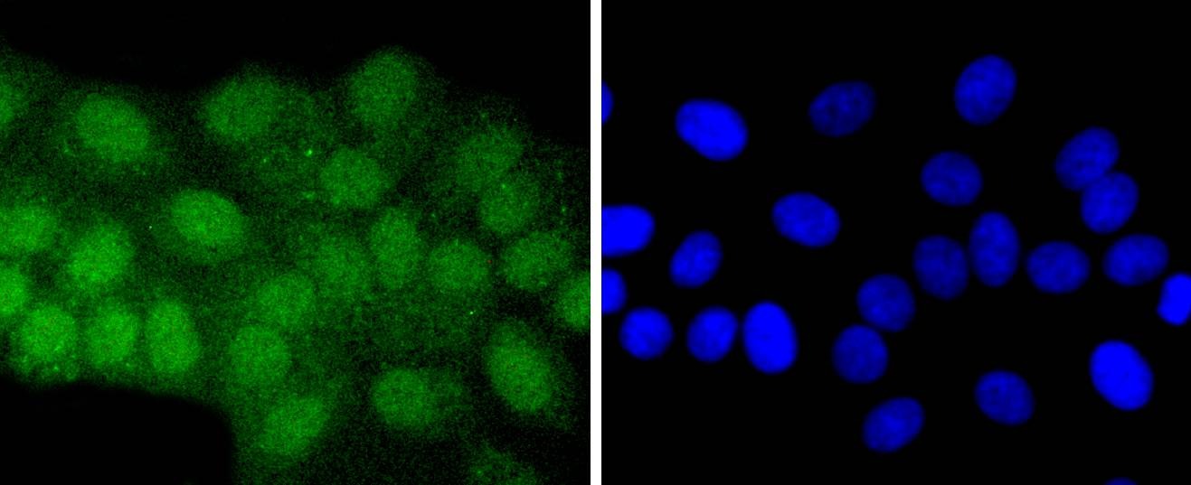 Anti-ATF7 Antibody (6F15)