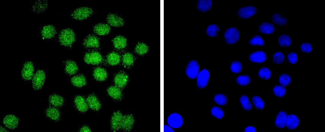 Anti-BMI-1 Antibody (4I124)
