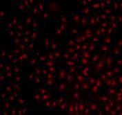 Anti-BMI-1 Antibody (8M743)