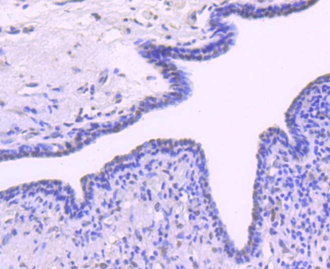 Anti-BMI-1 Antibody (4I124)