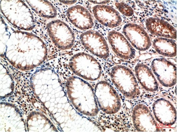 Anti-ATM Antibody (6V835)
