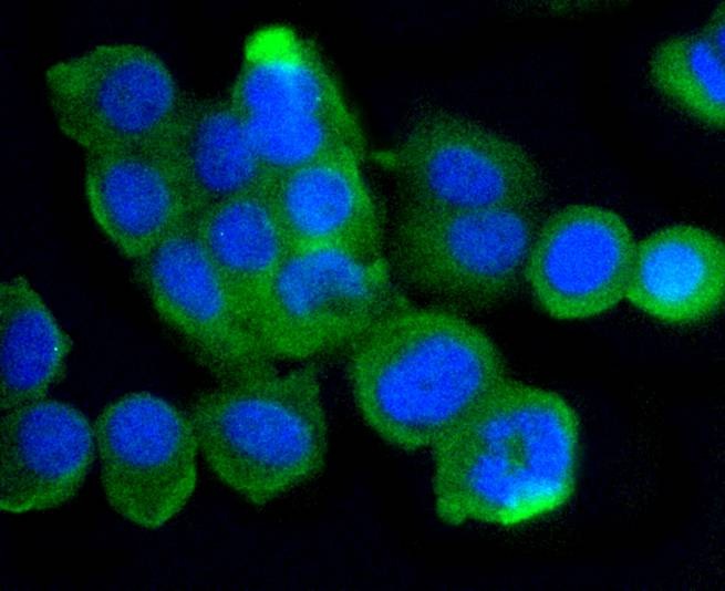 Anti-ATM Antibody (9B624)