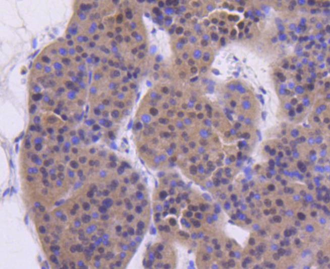 Anti-ATM Antibody (9B624)
