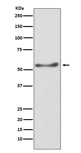 Anti-ATP5A1 Antibody (7X811)