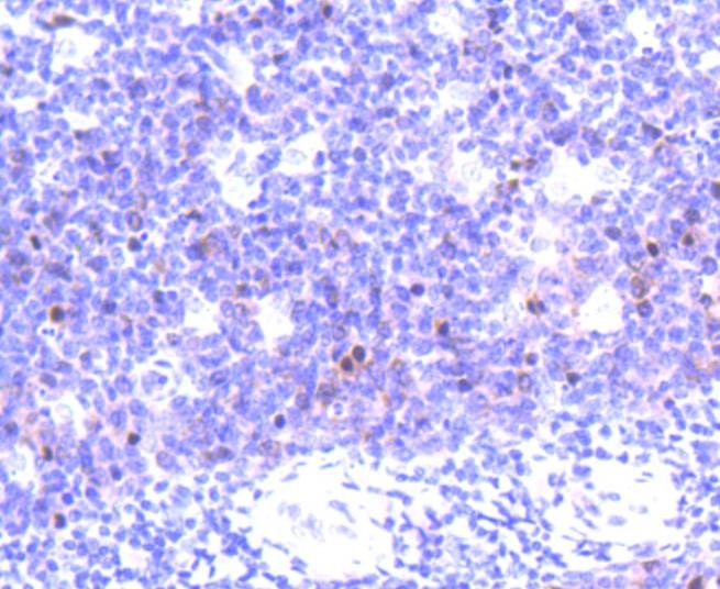 Anti-AURKB Antibody (8W890)