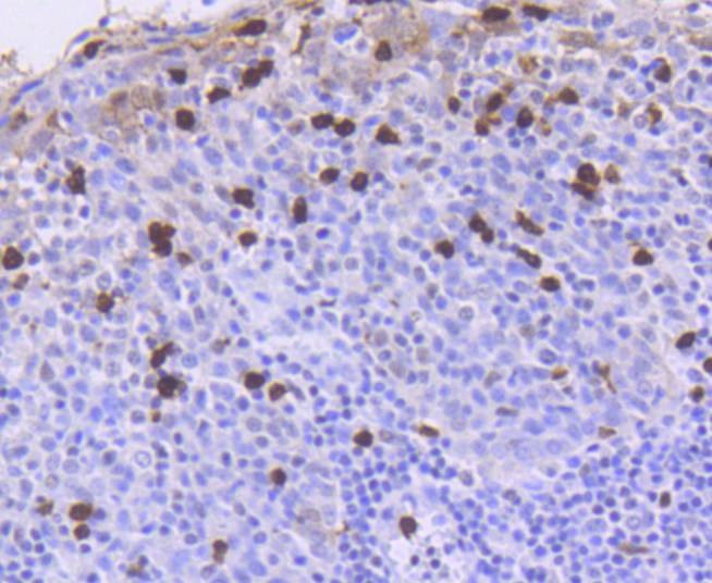 Anti-ATM Antibody (9B624)