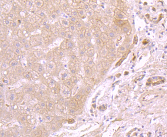 Anti-ATP5A1 Antibody (7X811)