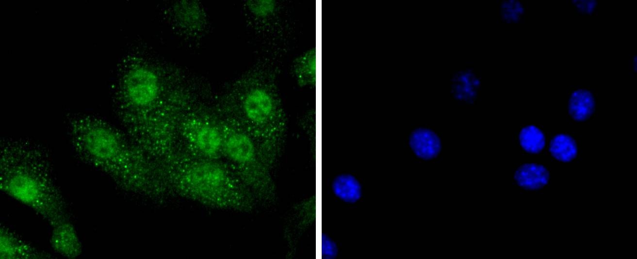 Anti-AURKA Antibody (1Y815)