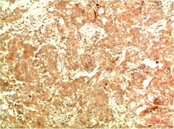 Anti-ATG5 Antibody (3M169)